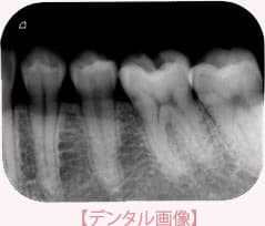 長崎 諫早市 諫早ふじた歯科・矯正歯科 CTにより精度が上がる治療