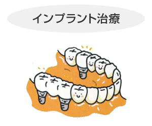 長崎 諫早市 諫早ふじた歯科・矯正歯科 針金付きの入れ歯ではなく、歯の無い部分に適切な数のインプラントを入れ、固定式の人工歯を取り付けます。