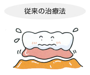 長崎 諫早市 諫早ふじた歯科・矯正歯科 入れ歯がズレたり、食べ物が内側に入って痛かったりします。