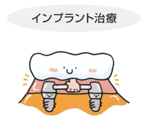 長崎 諫早市 諫早ふじた歯科・矯正歯科 数本のインプラントを入れて、入れ歯の固定源となる維持装置を取り付けます。