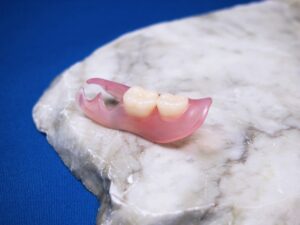 歯医者　ふじた歯科　義歯　金具の目立たない入れ歯　フレキサイト