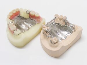 歯医者　ふじた歯科　入れ歯　金属床義歯　薄い入れ歯　頑丈　丈夫な入れ歯