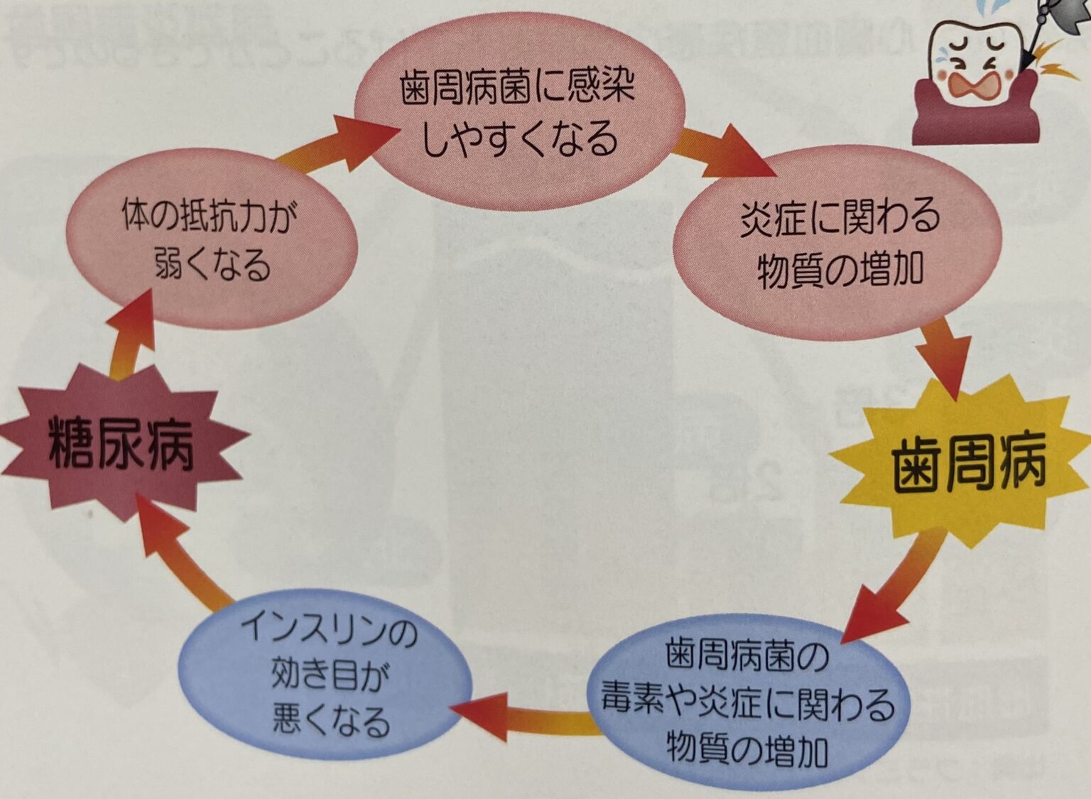 歯周病と糖尿病の関係について 諫早市の歯医者諫早ふじた歯科・矯正歯科 ｜インプラント、審美歯科、予防歯科