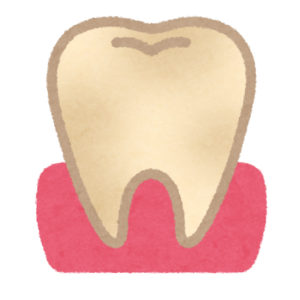 歯が黄ばむ原因と対策
