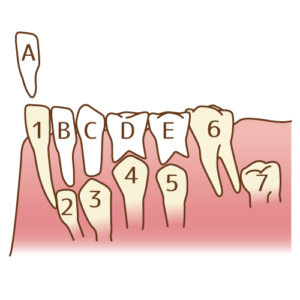 混合歯列期（小児歯科）の特徴