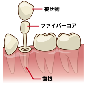 諫早　ふじた歯科　矯正歯科