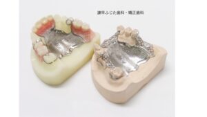 歯周病と入れ歯