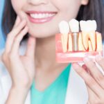 インプラント治療で悪い歯並びは治せるかなどについて説明するイメージ