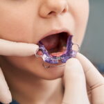 床矯正の治療をする子ども