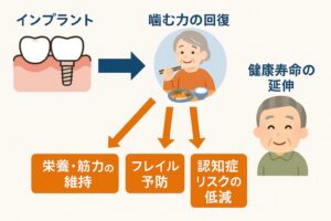 インプラントの効果