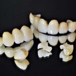 セラミックの歯のイメージ