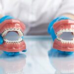 ワイヤー矯正の模型を持つ手